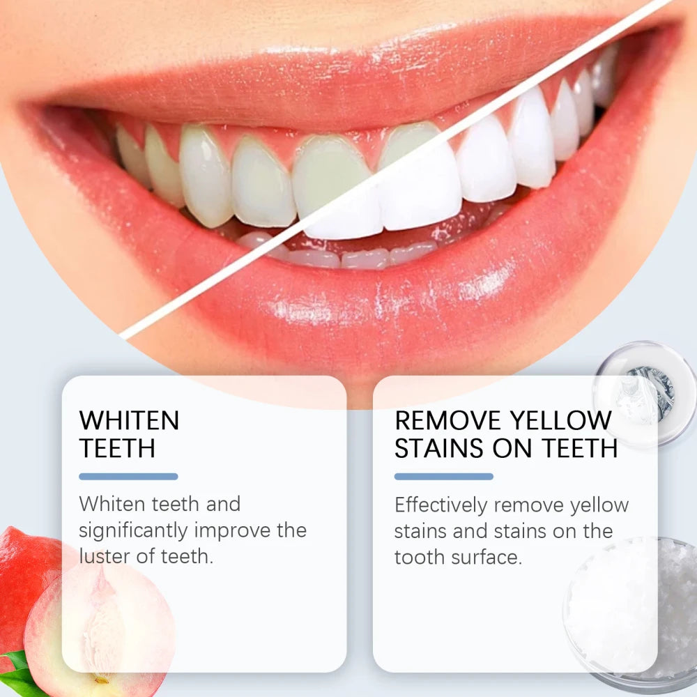Oralhoe Niacinamide Teeth Whitening Toothpaste
